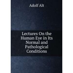   Human Eye in Its Normal and Pathological Conditions: Adolf Alt: Books
