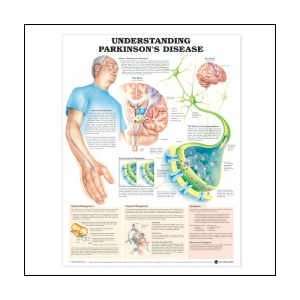  Understanding Parkinsons Disease Anatomical Chart 20 X 