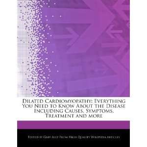  Dilated Cardiomyopathy Everything You Need to Know About 