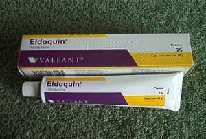 Eldoquin Hydroquinone 2% Skin Lightening Cream used 4 melasma  