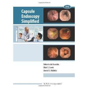  Capsule Endoscopy Simplified [Spiral bound] Roberto 